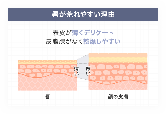 唇が荒れやすい理由 表皮が薄くデリケート皮脂腺がなく乾燥しやすい